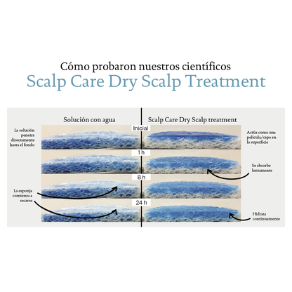 Scapl Care Dry Scalp Treatment 100 ml- Tratamiento cuero cabelludo